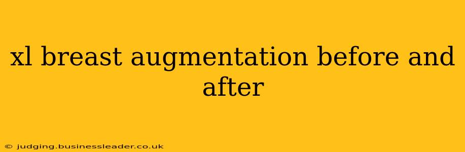 xl breast augmentation before and after
